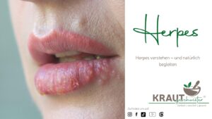 🦠 Herpes – der unsichtbare Dauergast