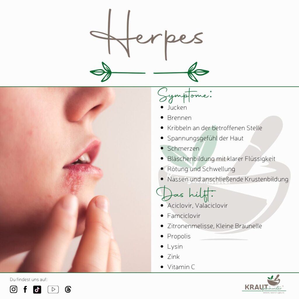 🦠 Herpes – der unsichtbare Dauergast