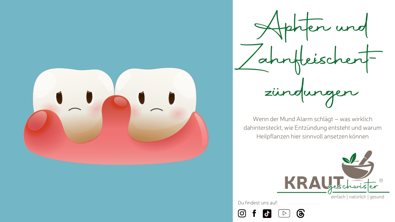 Mehr über den Artikel erfahren Aphten und Zahnfleischentzündungen