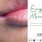 Eingerissene Mundwinkel