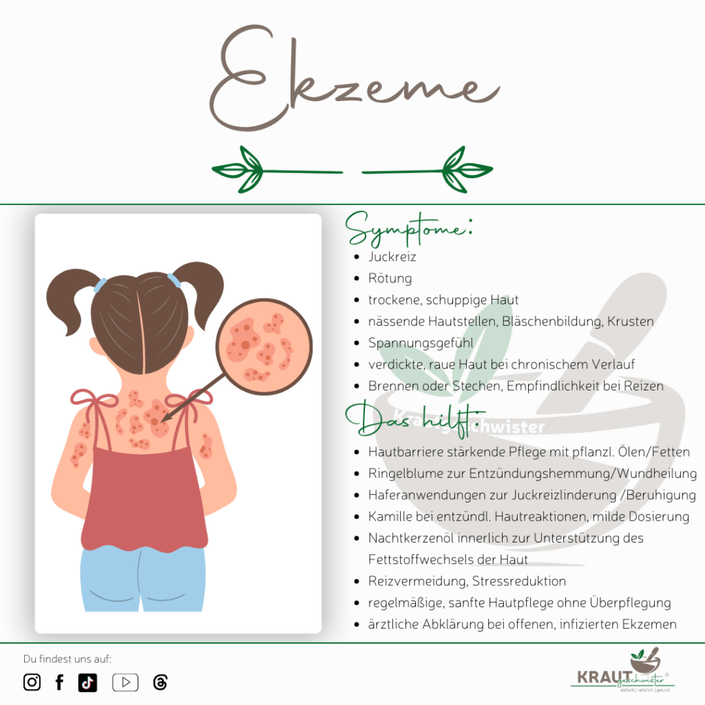 Ekzeme verstehen, begleiten und pflegen