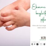 Ekzeme verstehen, begleiten und pflegen