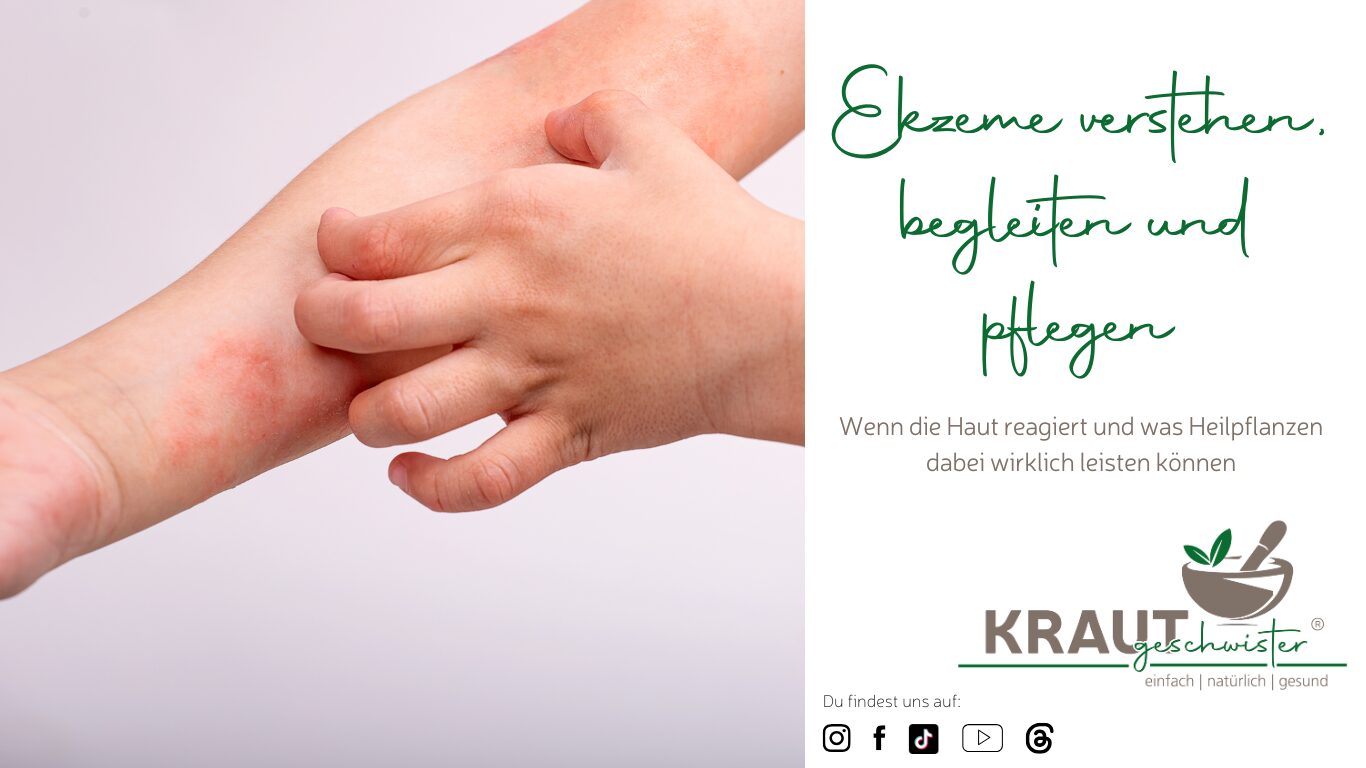Mehr über den Artikel erfahren Ekzeme verstehen, begleiten und pflegen