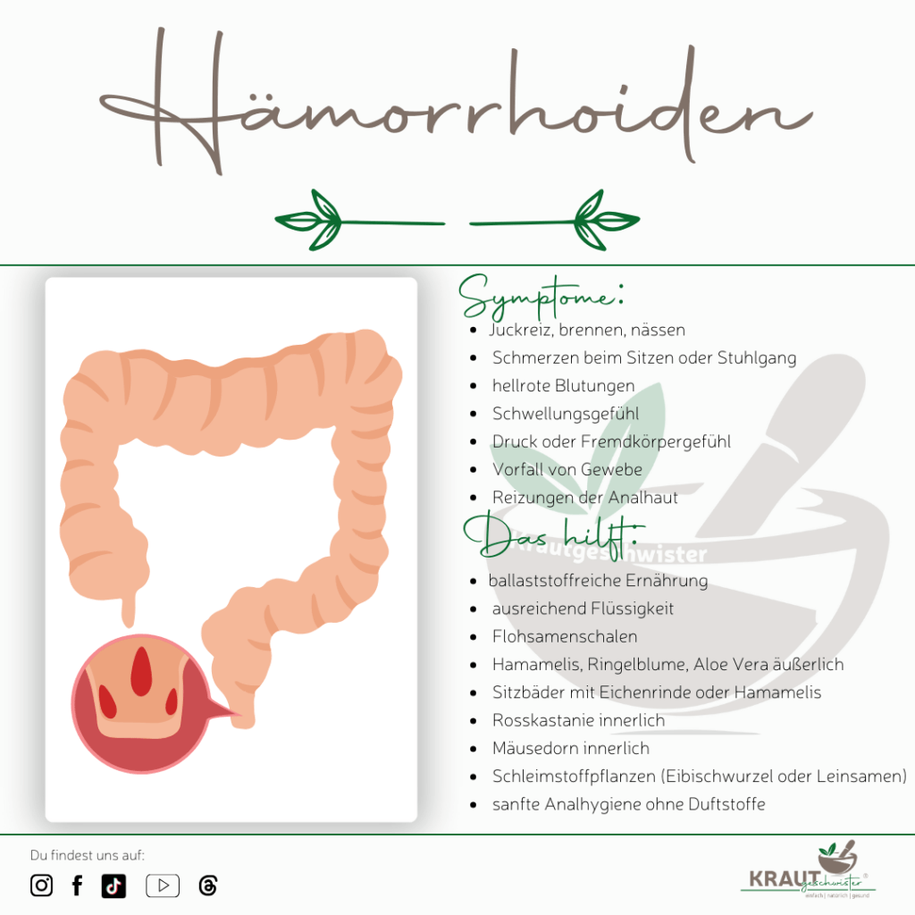 H&auml;morrhoiden verstehen statt verstecken