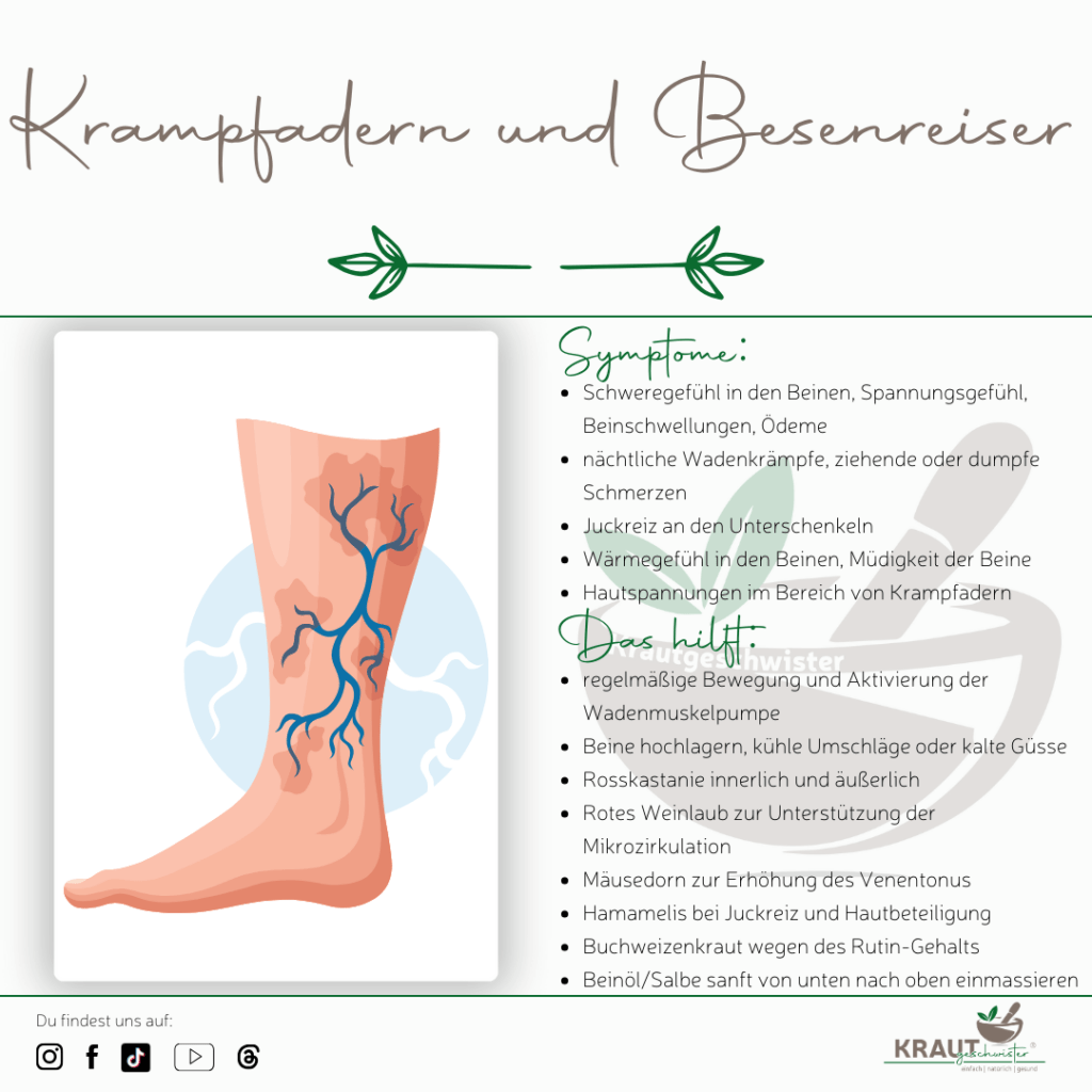 Krampfadern und Besenreiser