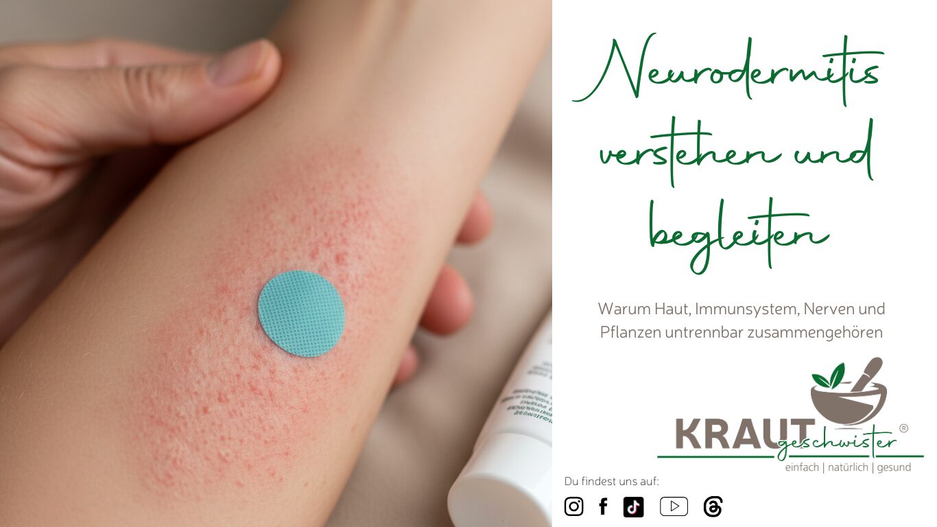 Neurodermitis verstehen und begleiten