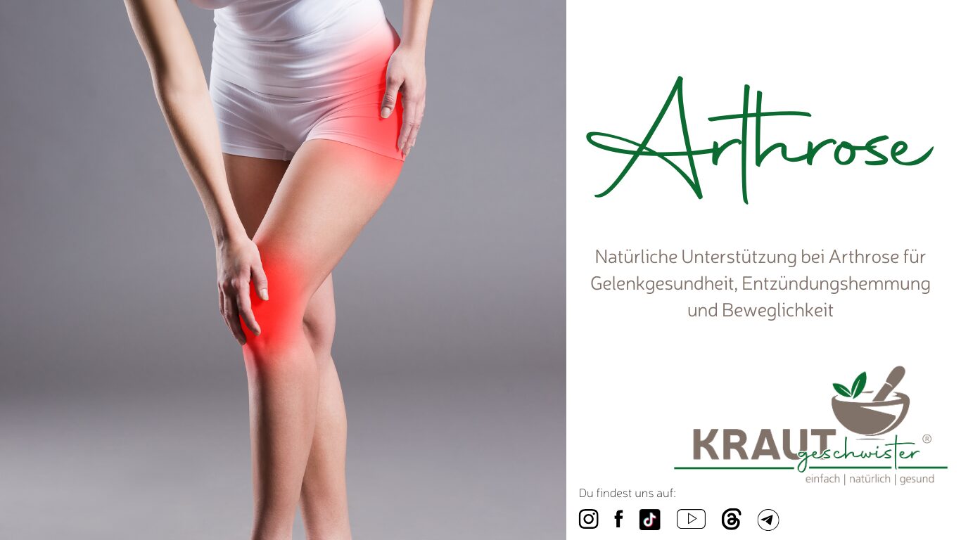 Mehr über den Artikel erfahren Arthrose