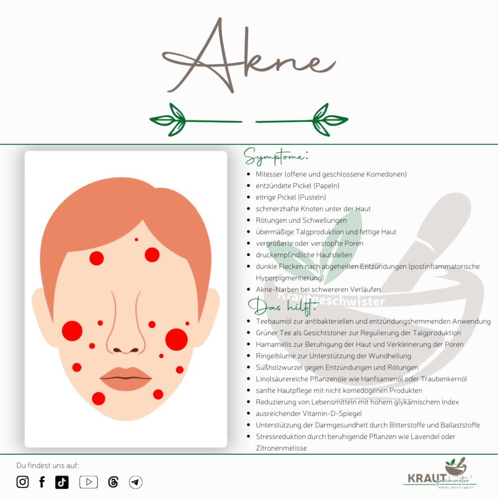 Akne mit Pflanzenwissen begleiten