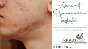 Akne mit Pflanzenwissen begleiten