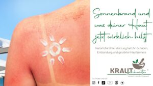 Sonnenbrand und was deiner Haut jetzt wirklich hilft