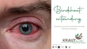 Bindehautentz&uuml;ndung: Wenn das Auge Alarm schl&auml;gt