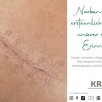 Narben – Die erstaunliche Biologie unserer sichtbaren Erinnerungen