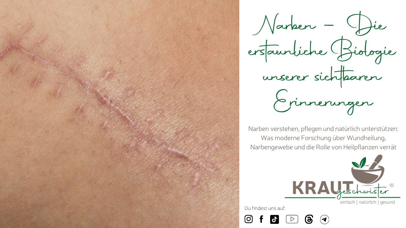 Mehr über den Artikel erfahren Narben – Die erstaunliche Biologie unserer sichtbaren Erinnerungen