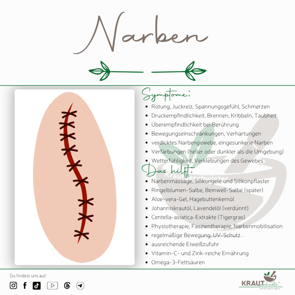 Narben &ndash; Die erstaunliche Biologie unserer sichtbaren Erinnerungen